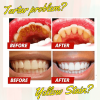 WE2C Whitening Toothpaste Teeth Cleaning Toothpaste Remove Plaque Remove Stains Oral Ordor Cleaning Bright Teeth Breath, Jasmine, Mint Gum Protection